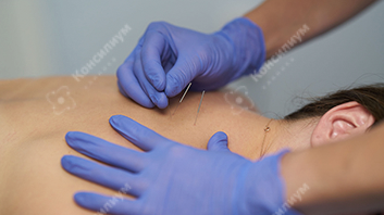 С 14 декабря в клинике «Консилиум» можно пройти курс процедур иглоукалывания С 14 декабря в клинике «Консилиум» можно пройти курс процедур иглоукалывания