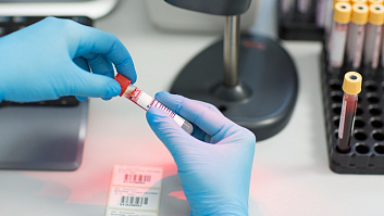 Скидка 15% на анализы крови Скидка 15% на анализы крови